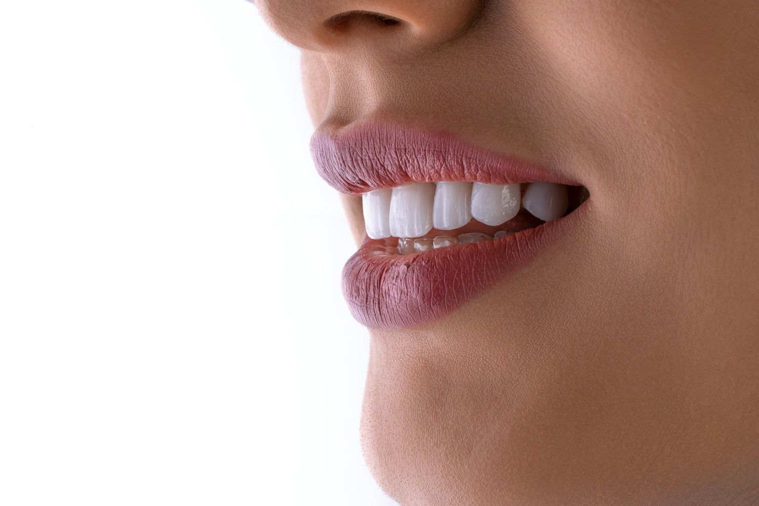 Gros plan sur un sourire aux dents naturelles